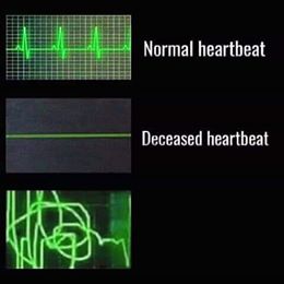 Heartbeat Comparison Meme Template