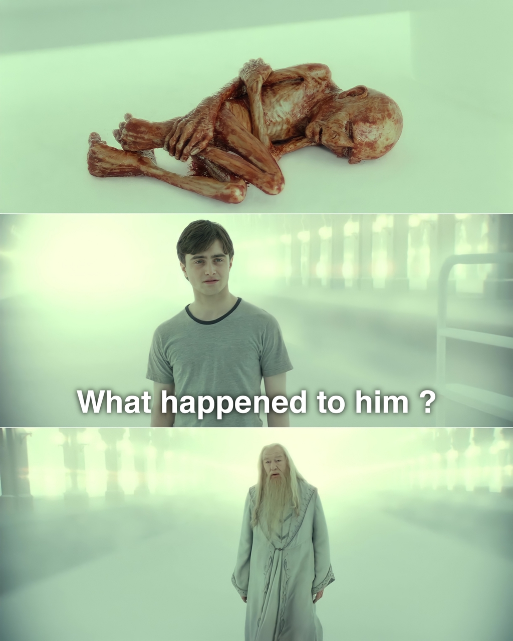 What Happened To Him? Meme Template